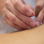 Community Acupuncture (Manchester)
