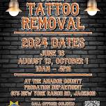 August 13 Tattoo Removal Event