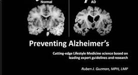 Preventing Alzheimer